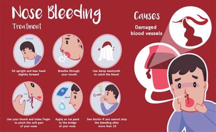 Can nose bleeds mean something serious?