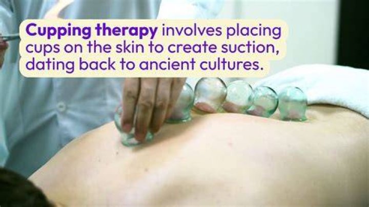 Can you do cupping on your stomach?