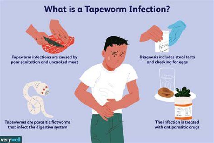 Can you poop out tapeworms?