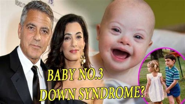 Do George Clooney's Kids Have Down Syndrome? Uncover The Truth