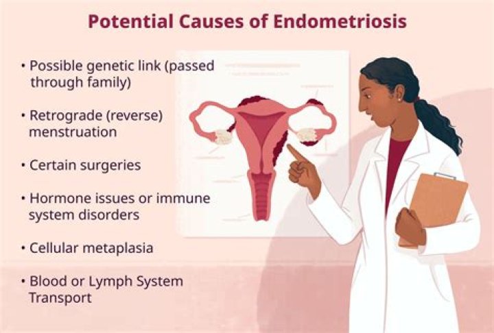 Does endometriosis shorten your lifespan?