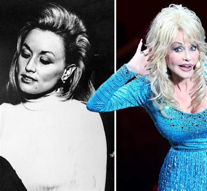 Dolly Parton And Her Iconic Breast Implants: A Journey Through Fame
