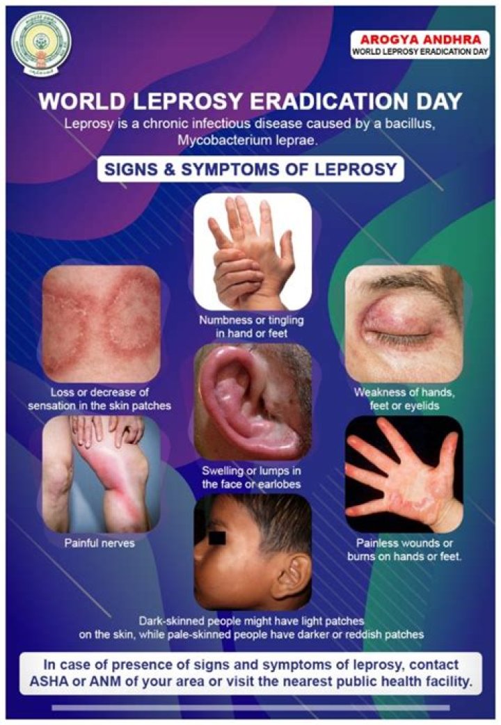 How long does it take for leprosy symptoms to show?