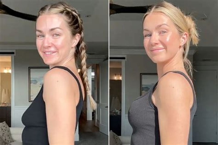 Unveiling Sabrina Carpenter's Cheek Implants Journey